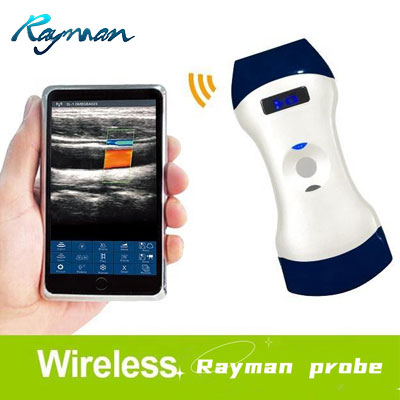 2 in 1 Wireless Ultrasound Probe